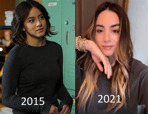 chloe bennet plastic surgery
